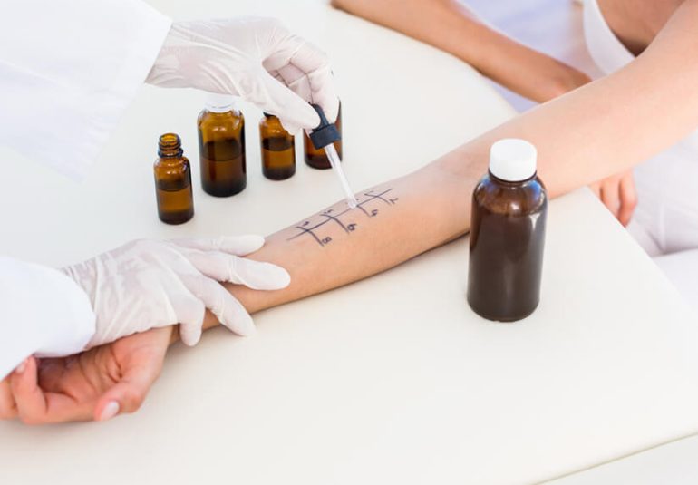 Delme Testi (Prick Test)