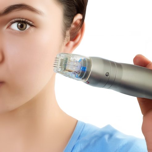 ALTIN İĞNELİ RADYOFREKANS UYGULAMASI