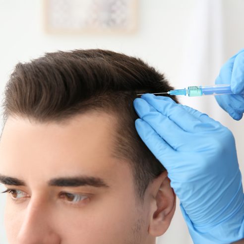 SAÇ PRP (PLATELET RİCH PLAZMA)