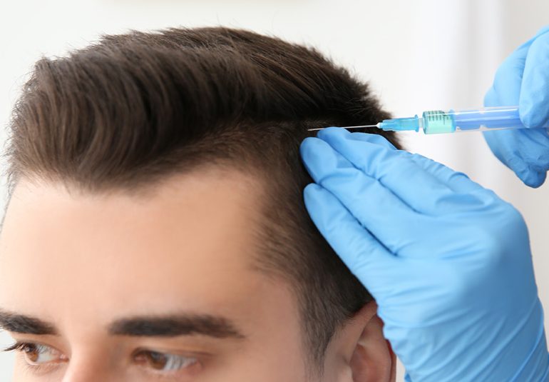 SAÇ PRP (PLATELET RİCH PLAZMA)