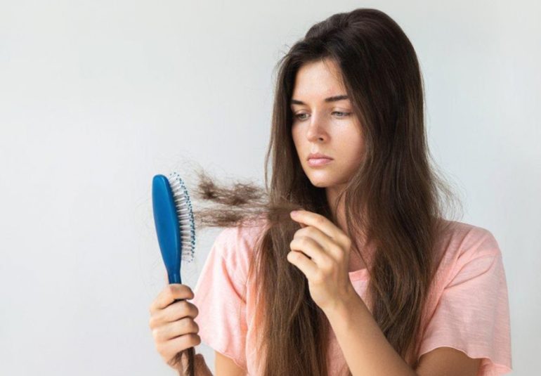 Tepkisel (Telogen) Saç dökülmesi